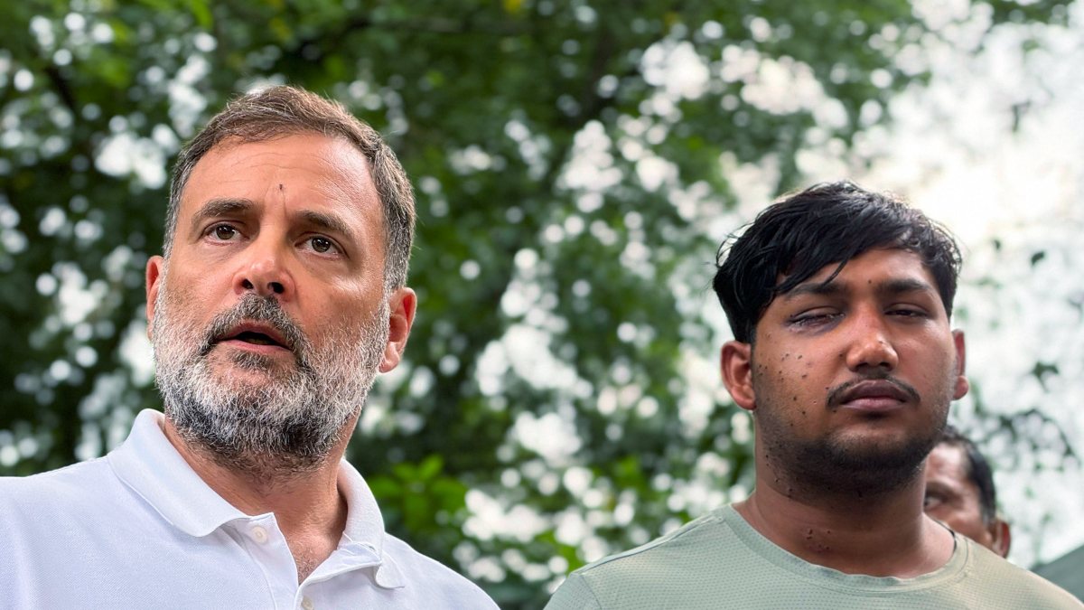 Rahul Gandhi meets student injured in Delhi police pellet firing